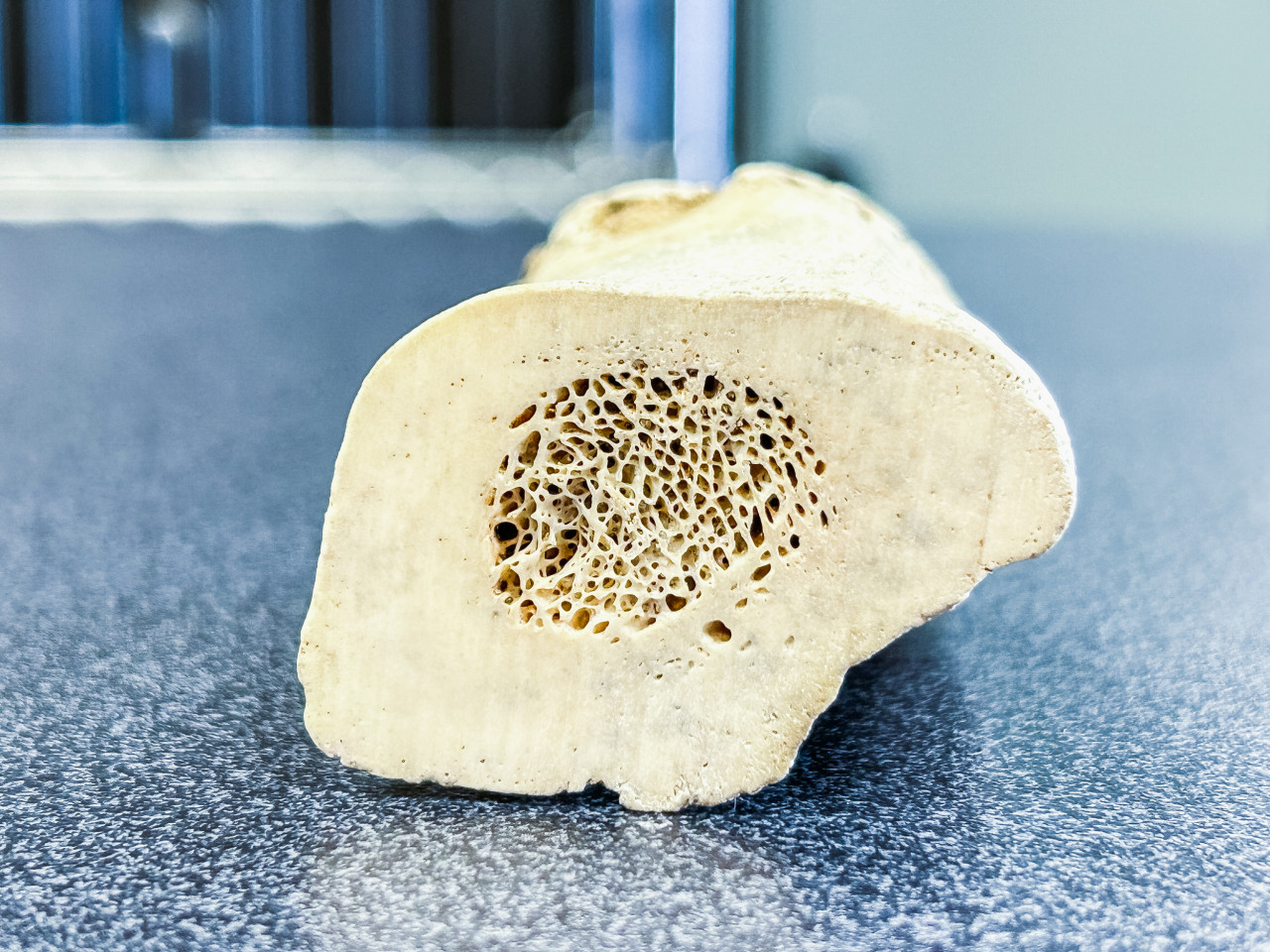 Fotografía muestra la porosidad del hueso 