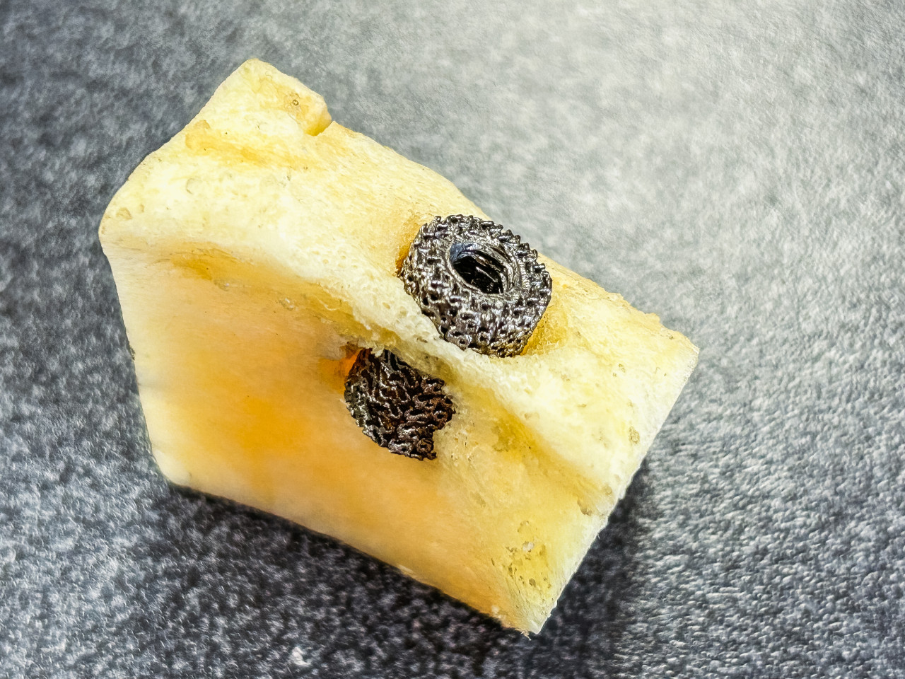 Implante introduciéndose en el hueso 