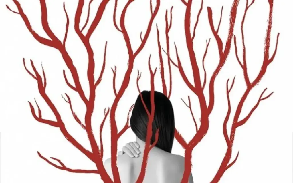 Ilustración
