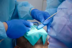 Acercamiento a la dentadura del estudiante mientras el odontólogo trabaja