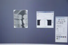 Detalle de los rayos X tomados al estudiante